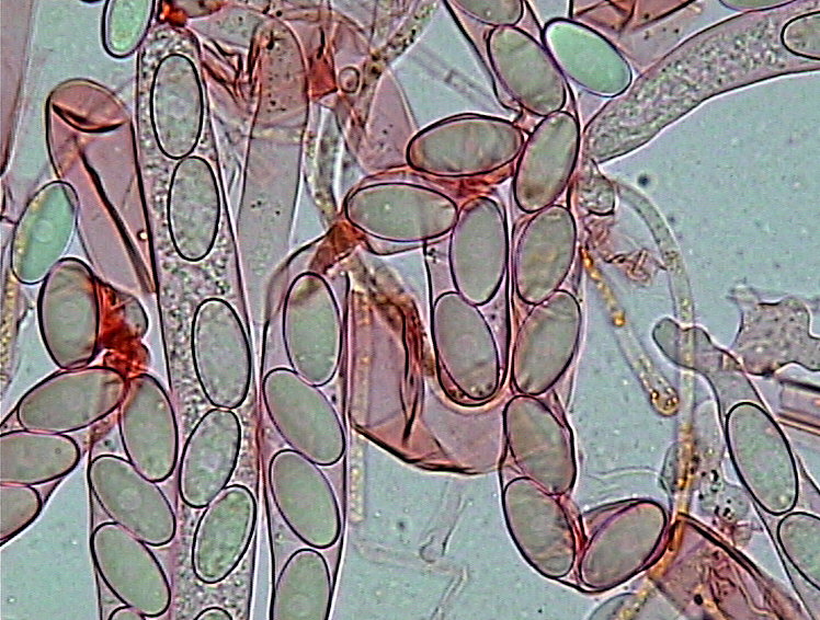 Cheilymenia stercorea (Pers. Fr.) Boud. f. stercorea